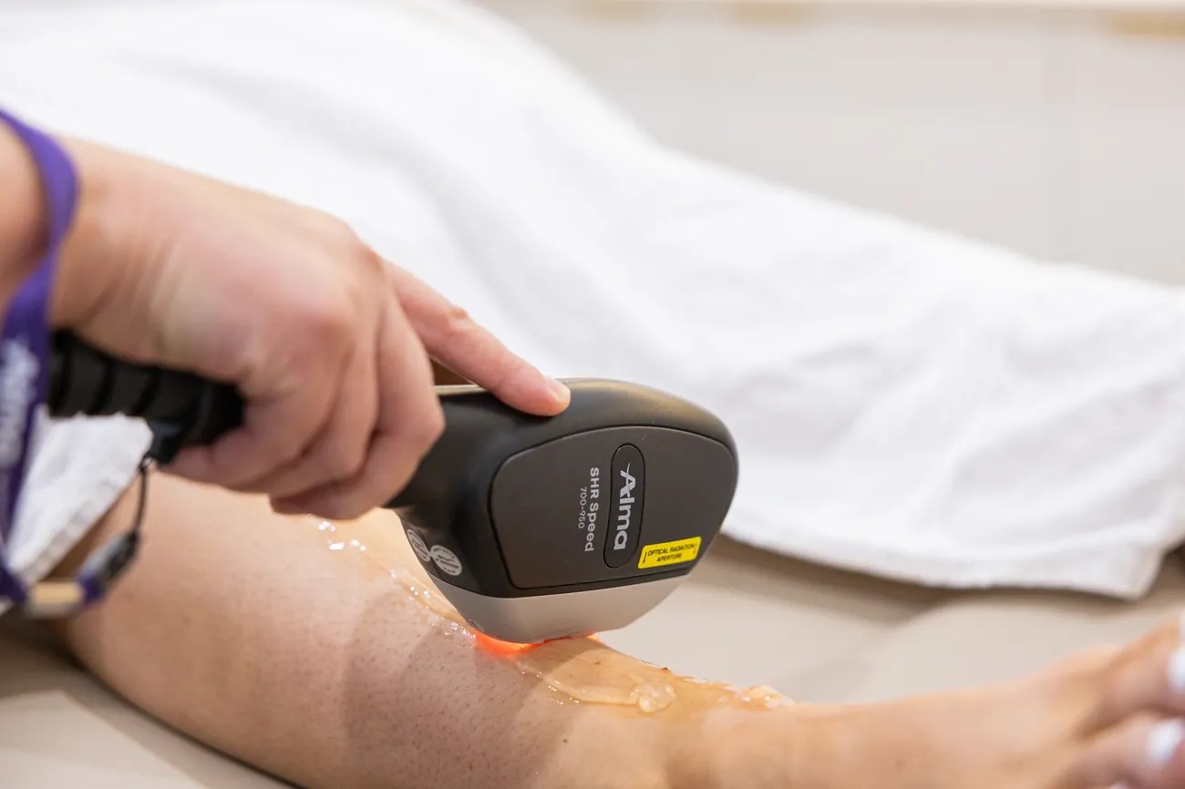 Hair Removal treatment at Sculpt Aesthetics